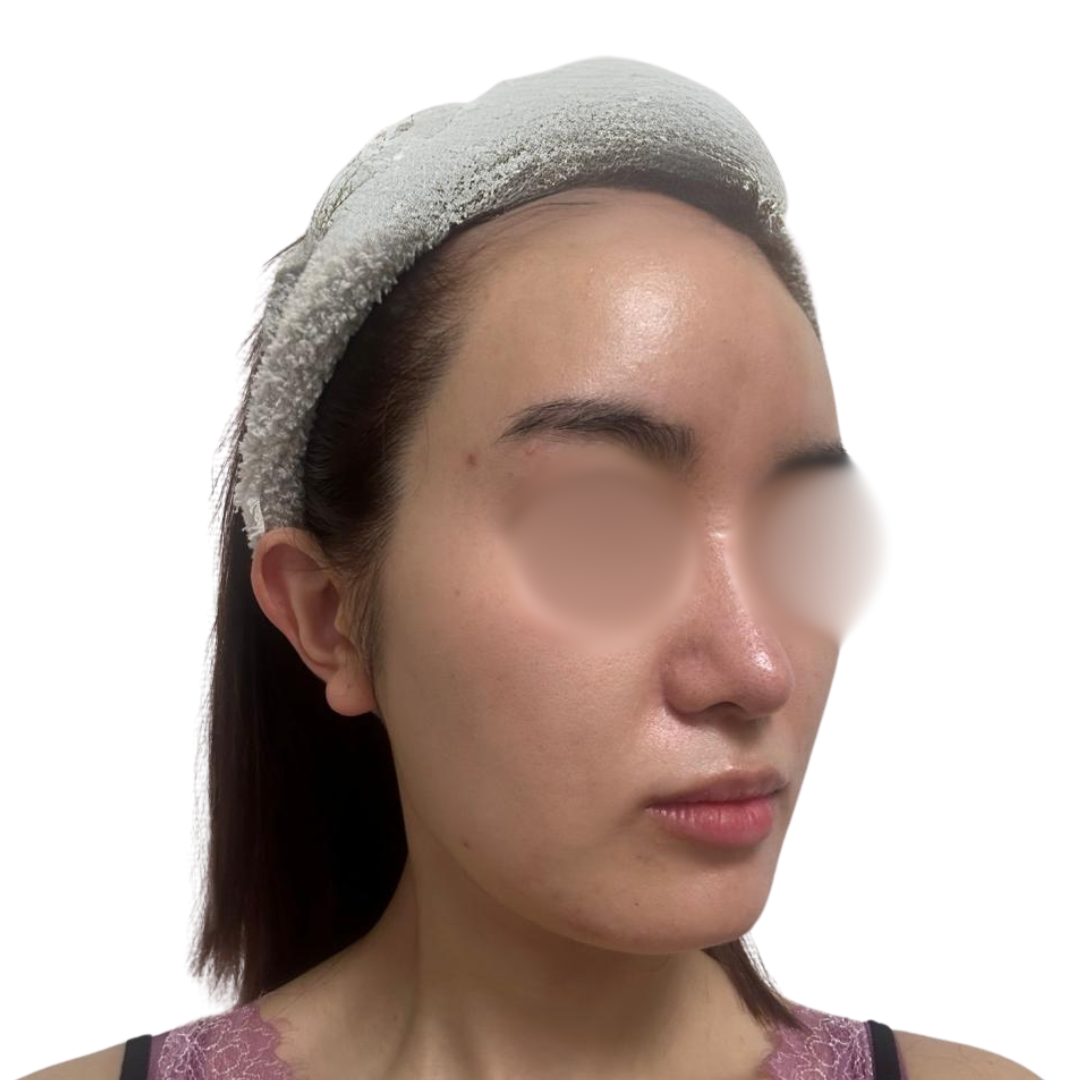 バイオリピール（ミラノリピール）